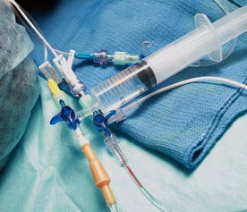 一次性醫(yī)療高值耗材的重復使用 第二類醫(yī)療器械銷售的道德、法律與風險分析